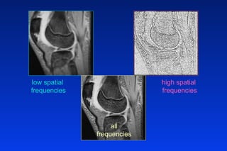 low spatial
frequencies
high spatial
frequencies
all
frequencies
 
