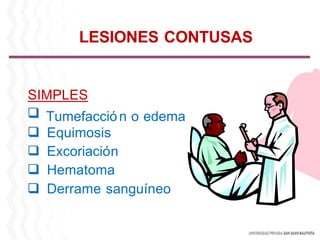 SIMPLES
Tumefacción o edema
Equimosis
Excoriación
Hematoma
Derrame sanguíneo
LESIONES CONTUSAS
 