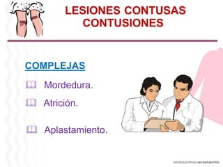 COMPLEJAS
 Mordedura.
 Atrición.
 Aplastamiento.
LESIONES CONTUSAS
CONTUSIONES
 