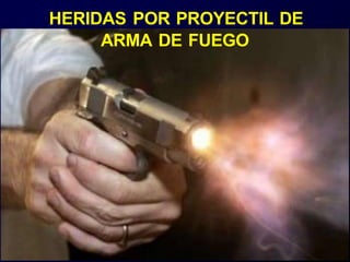 HERIDAS POR PROYECTIL DE
ARMA DE FUEGO
 