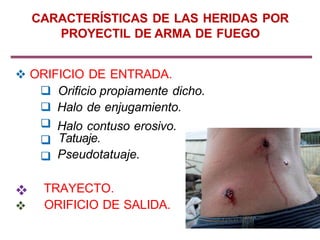 ORIFICIO DE ENTRADA.
Orificio propiamente dicho.
Halo de enjugamiento.
Halo contuso erosivo.
Tatuaje.
Pseudotatuaje.
TRAYECTO.
ORIFICIO DE SALIDA.
CARACTERÍSTICAS DE LAS HERIDAS POR
PROYECTIL DE ARMA DE FUEGO
 