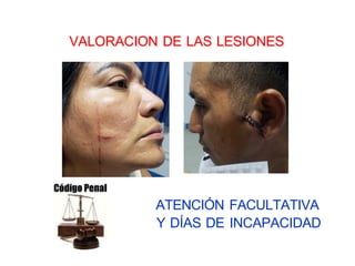 ATENCIÓN FACULTATIVA
Y DÍAS DE INCAPACIDAD
VALORACION DE LAS LESIONES
 