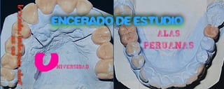U
ENCERADO DE ESTUDIO
CD.ESP.
JUANTIPISMANAMANCILLA
NIVERSIDAD
ALAS
PERUANAS
 