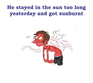 He stayed in the sun too long
yesterday and got sunburnt
 