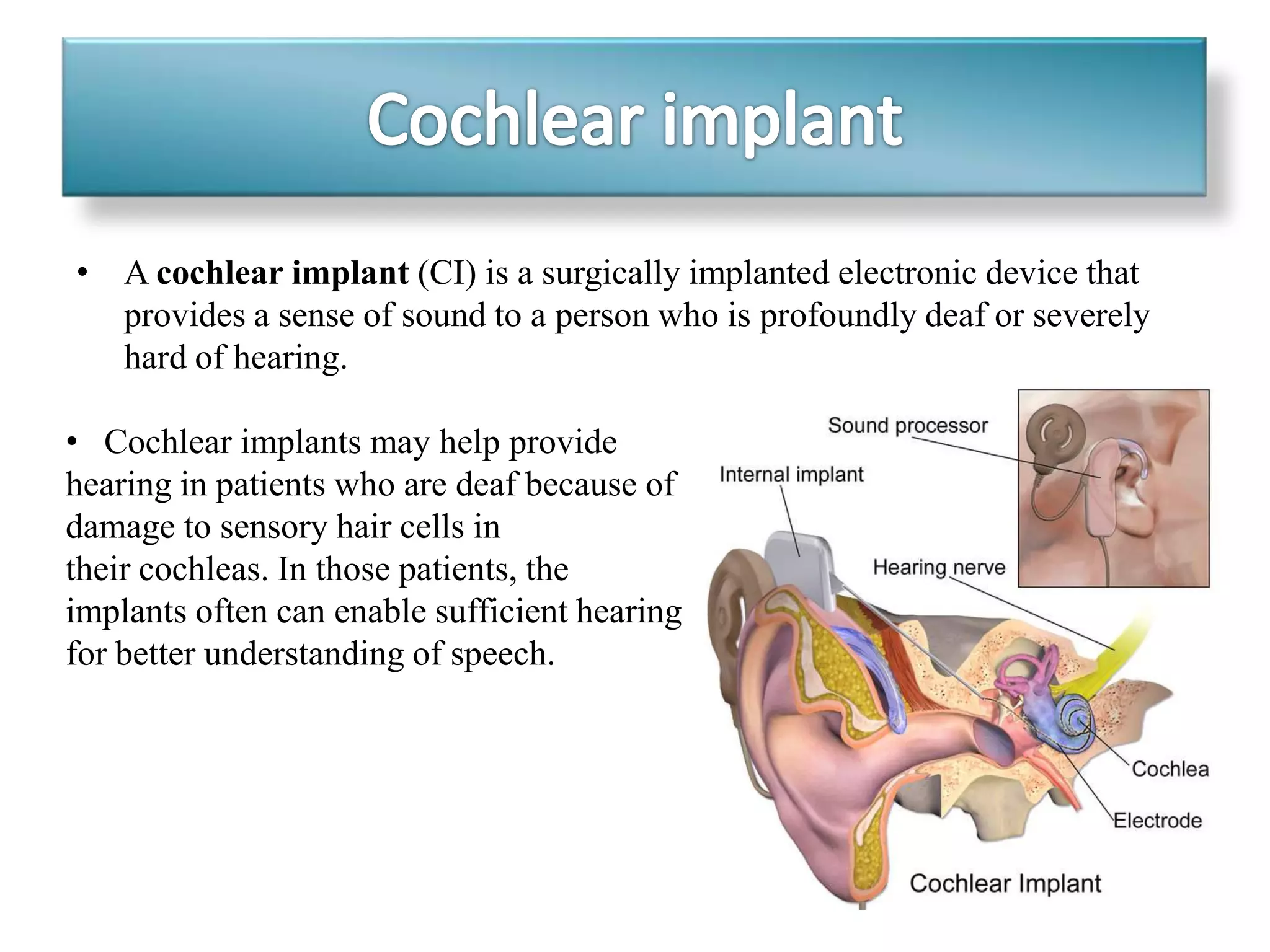 • A cochlear implant (CI) is a surgically implanted electronic device that
provides a sense of sound to a person who is profoundly deaf or severely
hard of hearing.
• Cochlear implants may help provide
hearing in patients who are deaf because of
damage to sensory hair cells in
their cochleas. In those patients, the
implants often can enable sufficient hearing
for better understanding of speech.
 