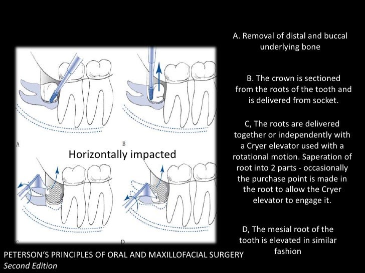 molar teeth