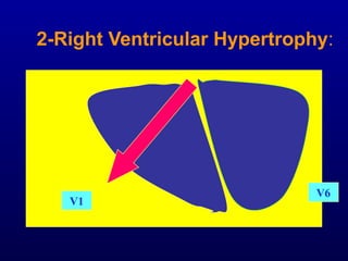 3rd part ECG Basics QRS complex Dr Salah Mabrouk Khallaf | PPT