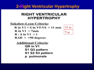 3rd part ECG Basics QRS complex Dr Salah Mabrouk Khallaf | PPT