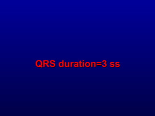 3rd part ECG Basics QRS complex Dr Salah Mabrouk Khallaf | PPT