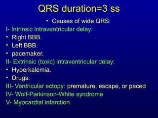 3rd part ECG Basics QRS complex Dr Salah Mabrouk Khallaf | PPT