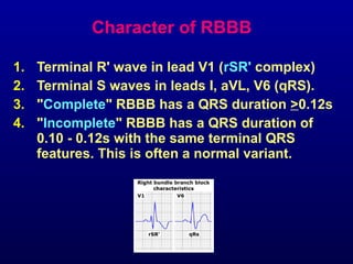 3rd part ECG Basics QRS complex Dr Salah Mabrouk Khallaf | PPT