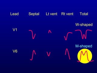 3rd part ECG Basics QRS complex Dr Salah Mabrouk Khallaf | PPT