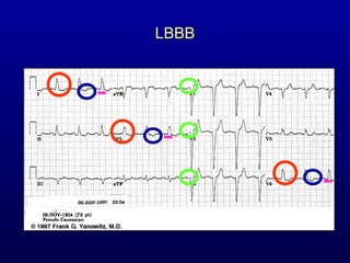 3rd part ECG Basics QRS complex Dr Salah Mabrouk Khallaf | PPT