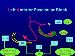 3rd part ECG Basics QRS complex Dr Salah Mabrouk Khallaf | PPT