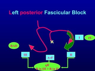 3rd part ECG Basics QRS complex Dr Salah Mabrouk Khallaf | PPT