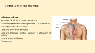 Central Line Indication Algorithm Surgical implications of venous drainage of face and neck | PPTX