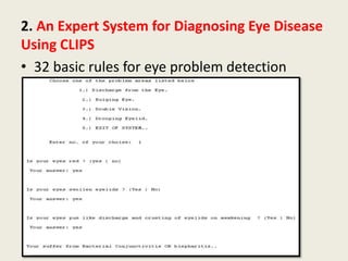 2. An Expert System for Diagnosing Eye Disease
Using CLIPS
• 32 basic rules for eye problem detection
 