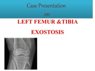 LEFT FEMUR &TIBIA
EXOSTOSIS
Case Presentation
on
 