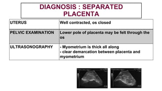 DIAGNOSIS : SEPARATED
PLACENTA
UTERUS Well contracted, os closed
PELVIC EXAMINATION Lower pole of placenta may be felt through the
os
ULTRASONOGRAPHY - Myometrium is thick all along
- clear demarcation between placenta and
myometrium
 