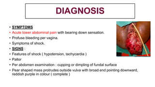 DIAGNOSIS
• SYMPTOMS
• Acute lower abdominal pain with bearing down sensation.
• Profuse bleeding per vagina.
• Symptoms of shock.
• SIGNS :
• Features of shock ( hypotension, tachycardia )
• Pallor
• Per abdomen examination : cupping or dimpling of fundal surface
• Pear shaped mass protrudes outside vulva with broad end pointing downward,
reddish purple in colour ( complete )
 