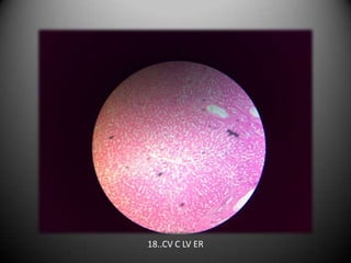 18..CV C LV ER
 