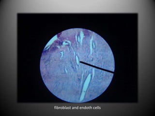 fibroblast and endoth cells
 