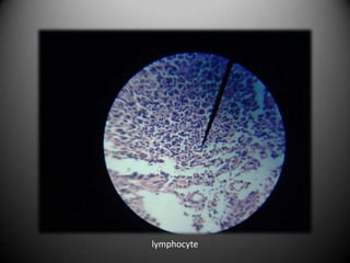 lymphocyte
 