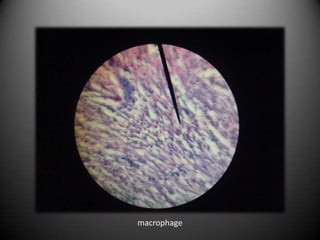 macrophage
 