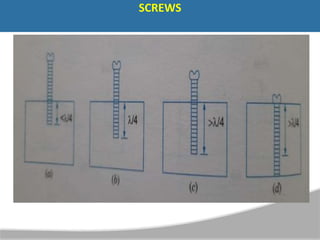 SCREWS
 