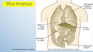 Situs Inversus
Ass.Prof.Dr. Saleh Nasser S. A. Alkardae
 