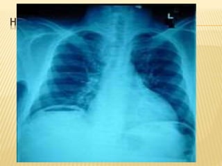 HERE IS YOUR PATIENT’S X-RAY….
 