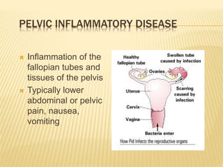 PELVIC INFLAMMATORY DISEASE
 Inflammation of the
fallopian tubes and
tissues of the pelvis
 Typically lower
abdominal or pelvic
pain, nausea,
vomiting
 