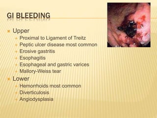 GI BLEEDING
 Upper
 Proximal to Ligament of Treitz
 Peptic ulcer disease most common
 Erosive gastritis
 Esophagitis
 Esophageal and gastric varices
 Mallory-Weiss tear
 Lower
 Hemorrhoids most common
 Diverticulosis
 Angiodysplasia
 