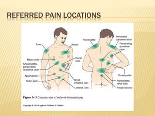 REFERRED PAIN LOCATIONS
 