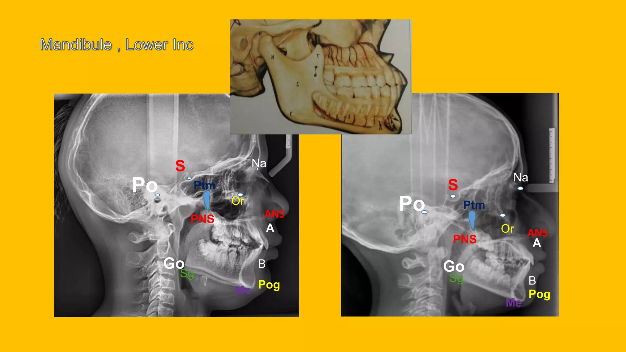 cephalometric 1 : Common points and plans | PPTX