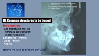 cephalometric 1 : Common points and plans | PPTX