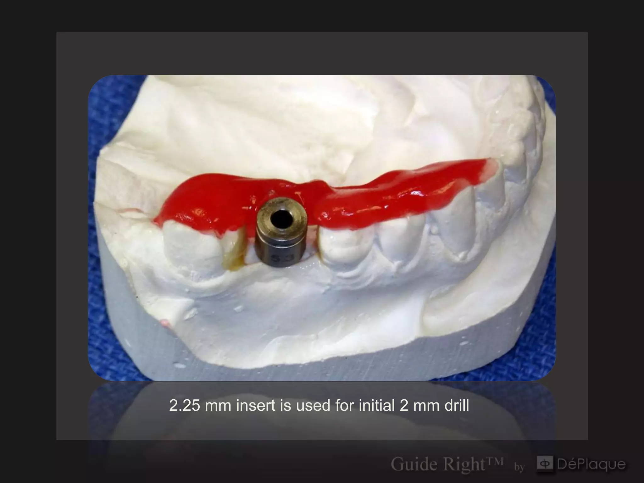 2.25 mm insert is used for initial 2 mm drill
 