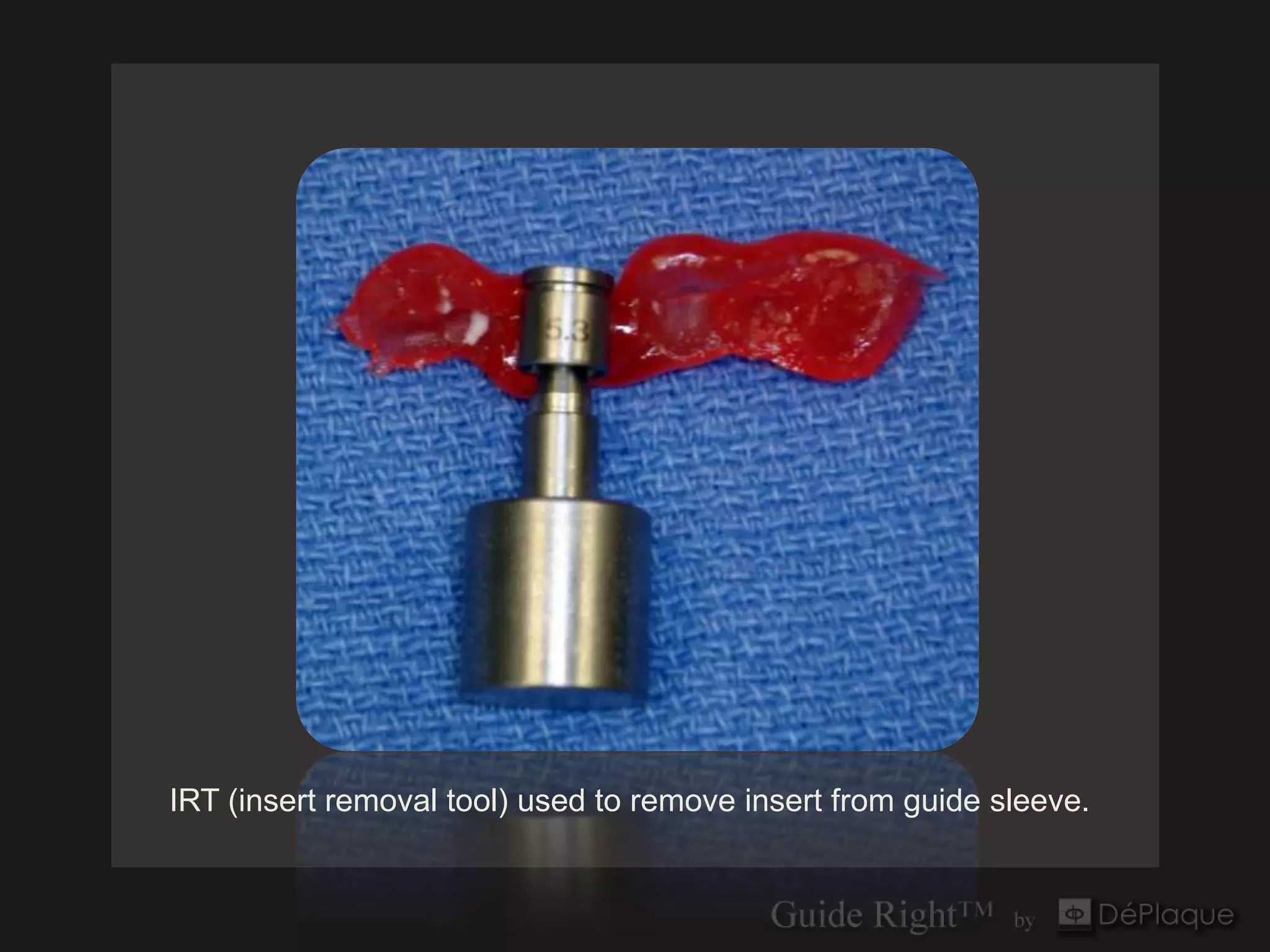 IRT (insert removal tool) used to remove insert from guide sleeve.
 