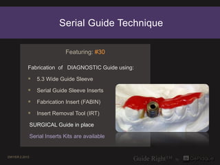 Serial Guide Technique

                              Featuring: #30

           Fabrication of DIAGNOSTIC Guide using:

            5.3 Wide Guide Sleeve
            Serial Guide Sleeve Inserts
            Fabrication Insert (FABIN)
            Insert Removal Tool (IRT)
               SURGICAL Guide in place

               Serial Inserts Kits are available


DWYER 2.2013
 