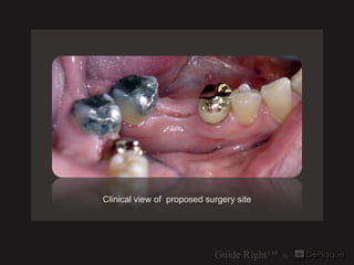 Clinical view of proposed surgery site
 