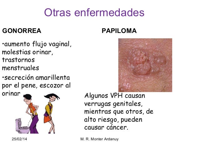 Como por medio de la carga aumentar el miembro