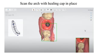 3 shape scanner.pdf