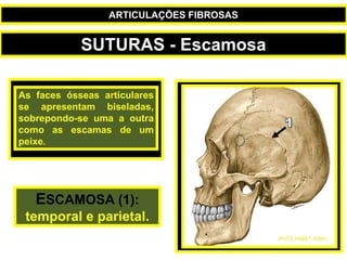 As faces ósseas articulares
se apresentam biseladas,
sobrepondo-se uma a outra
como as escamas de um
peixe.
ESCAMOSA (1):
temporal e parietal.
(PUTZ; PABST, 2000.)
SUTURAS - Escamosa
ARTICULAÇÕES FIBROSAS
 