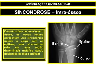 Durante a fase de crescimento
ósseo, os ossos longos
apresentam uma sincondrose
unindo o corpo com as
epífises, está sincondrose
está em uma região
denominada metáfise sendo
designada de disco epifisial
SINCONDROSE – Intra-óssea
ARTICULAÇÕES CARTILAGÍNEAS
 