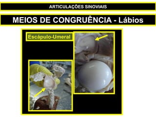Escápulo-Umeral
MEIOS DE CONGRUÊNCIA - Lábios
ARTICULAÇÕES SINOVIAIS
 