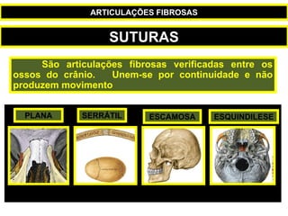 SUTURAS
São articulações fibrosas verificadas entre os
ossos do crânio. Unem-se por continuidade e não
produzem movimento
SERRÁTIL
PLANA ESCAMOSA ESQUINDILESE
ARTICULAÇÕES FIBROSAS
 