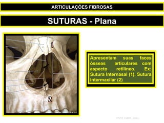 Apresentam suas faces
ósseas articulares com
aspecto retilíneo. Ex:
Sutura Internasal (1). Sutura
intermaxilar (2)
(PUTZ; PABST, 2000.)
SUTURAS - Plana
ARTICULAÇÕES FIBROSAS
 