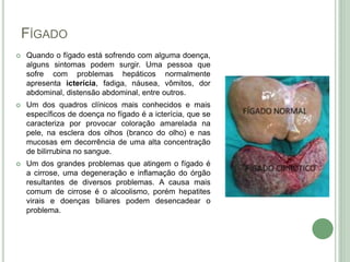FÍGADO
 Quando o fígado está sofrendo com alguma doença,
alguns sintomas podem surgir. Uma pessoa que
sofre com problemas hepáticos normalmente
apresenta icterícia, fadiga, náusea, vômitos, dor
abdominal, distensão abdominal, entre outros.
 Um dos quadros clínicos mais conhecidos e mais
específicos de doença no fígado é a icterícia, que se
caracteriza por provocar coloração amarelada na
pele, na esclera dos olhos (branco do olho) e nas
mucosas em decorrência de uma alta concentração
de bilirrubina no sangue.
 Um dos grandes problemas que atingem o fígado é
a cirrose, uma degeneração e inflamação do órgão
resultantes de diversos problemas. A causa mais
comum de cirrose é o alcoolismo, porém hepatites
virais e doenças biliares podem desencadear o
problema.
 