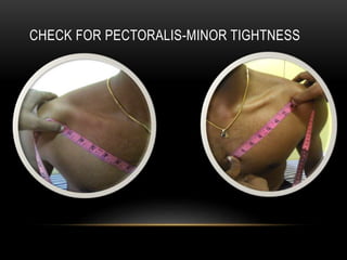 CHECK FOR PECTORALIS-MINOR TIGHTNESS 
 