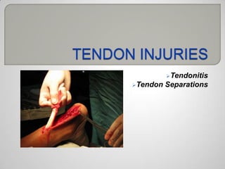Power Point SPORTS INJURIES 3º ESO Secciones